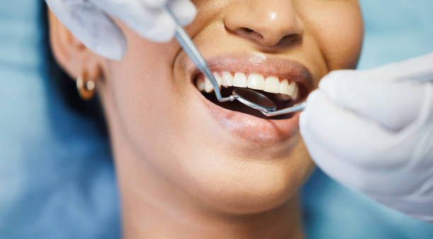  Paris, TX Emergency Dentist Pros