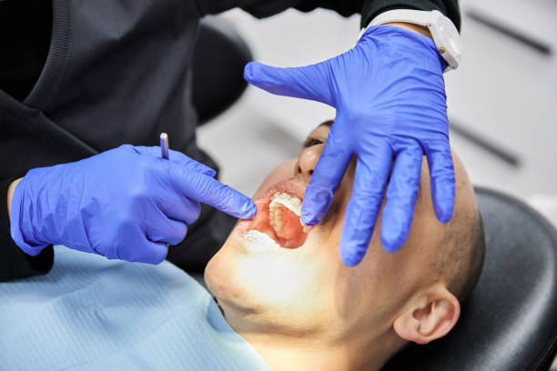 Best Emergency Root Canal Treatment in Paris, TX